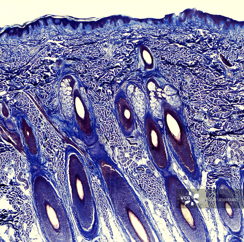 人的头皮，光学显微照片图片素材