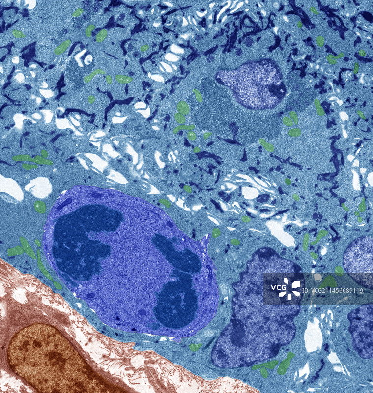 鳞状上皮细胞透射电镜图图片素材