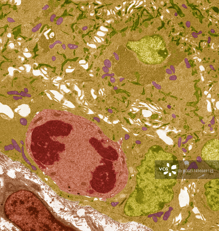 鳞状上皮细胞透射电镜图图片素材