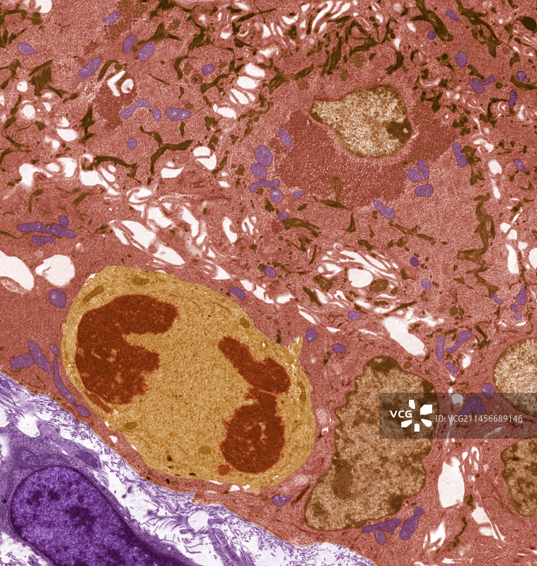 鳞状上皮细胞透射电镜图图片素材
