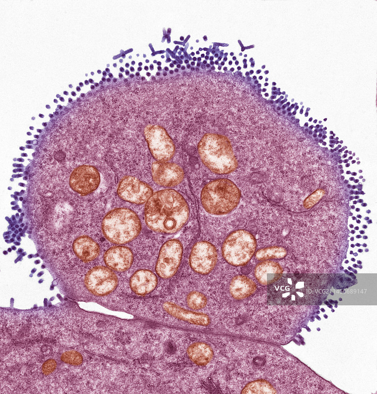 水泡性口炎病毒，TEM图片素材