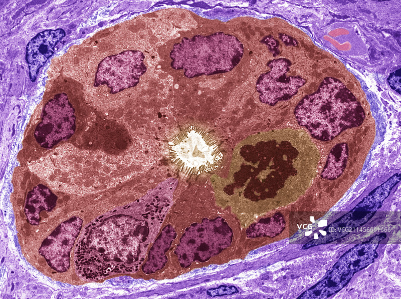 小肠透射电镜图片素材