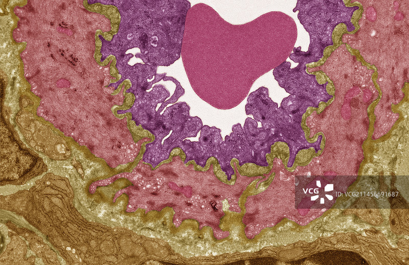 高内皮静脉，TEM图片素材