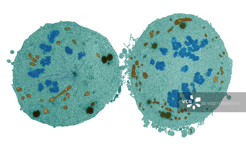 癌细胞分裂，透射电镜图片素材