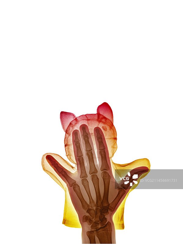 手部木偶X光片图片素材
