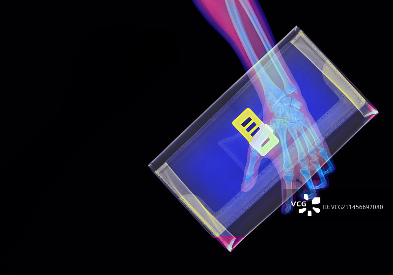 手拿包X光片图片素材