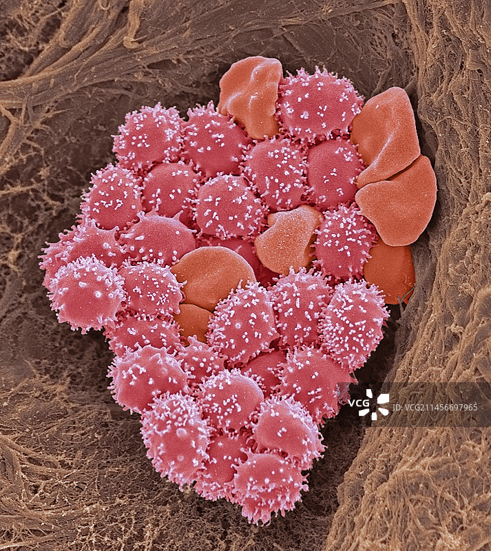 锯齿状红细胞扫描电镜图图片素材