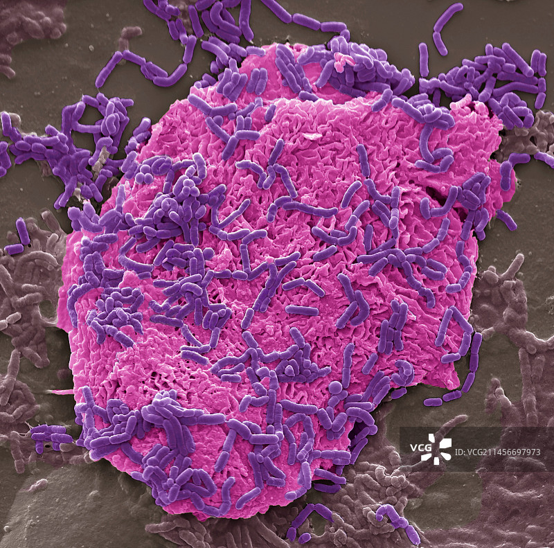 皮肤细菌扫描电镜图图片素材