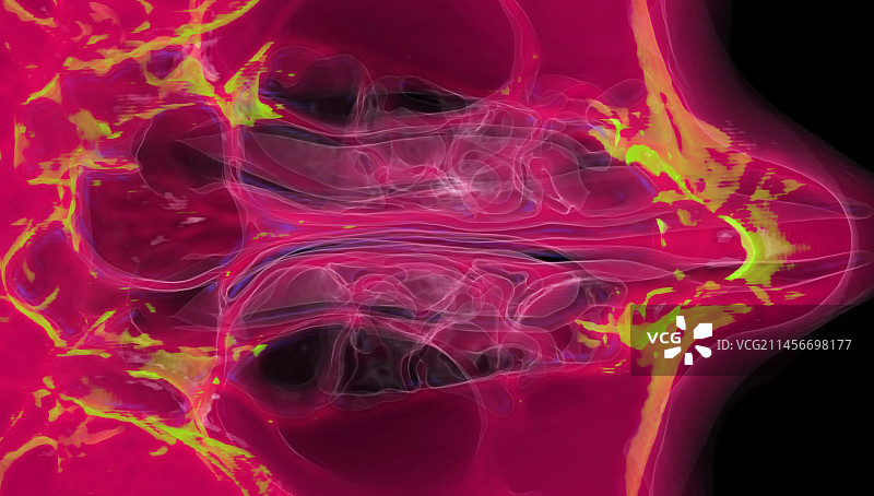 鼻旁窦，3D CT扫描图片素材