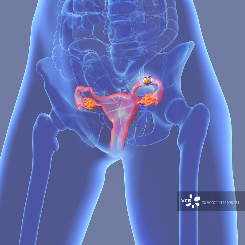 异位妊娠插图图片素材