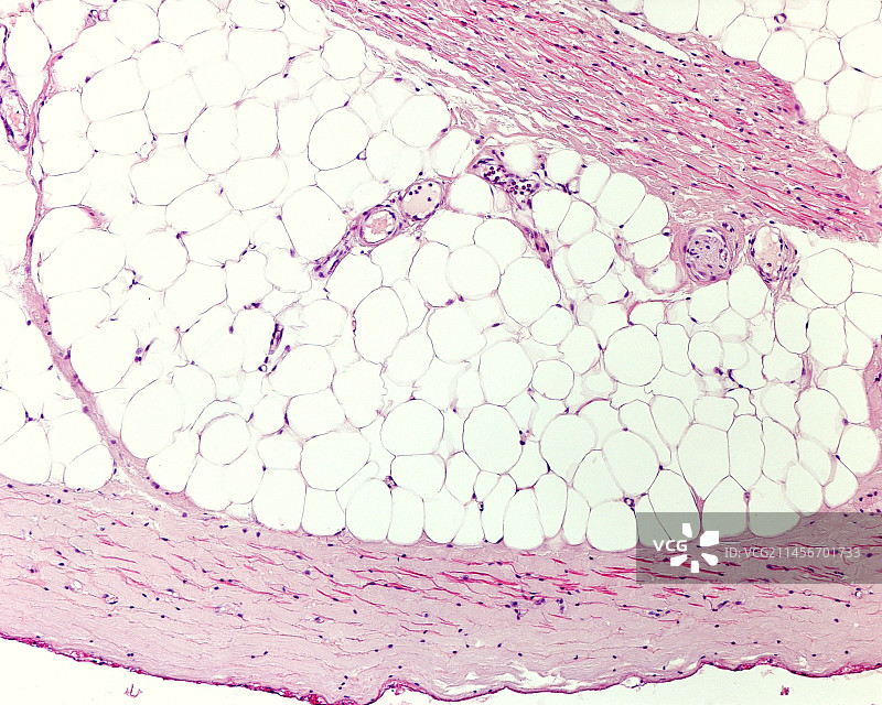 脂肪组织，光学显微照片图片素材