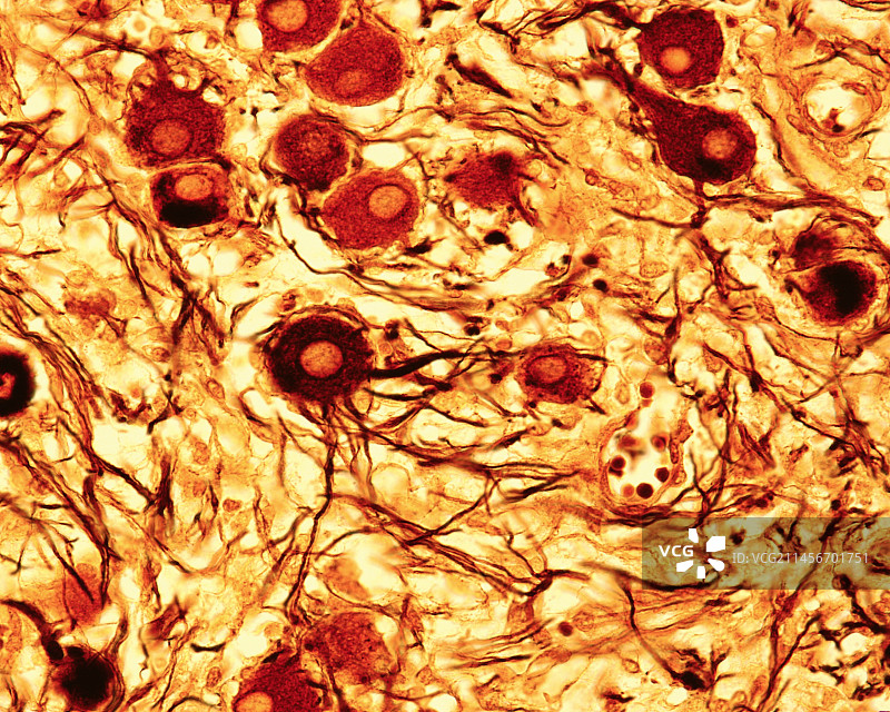 交感神经节显微照片图片素材