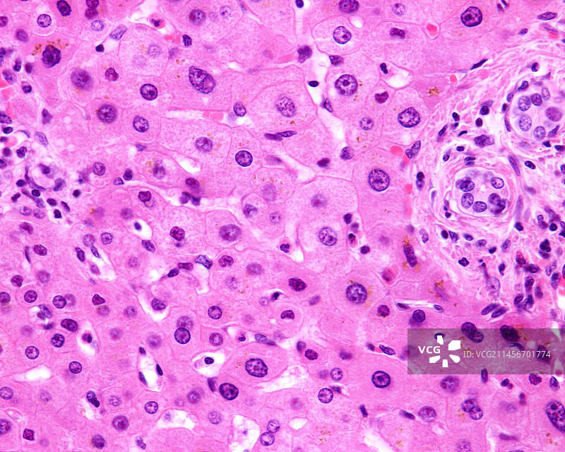 多倍体肝细胞显微照片图片素材