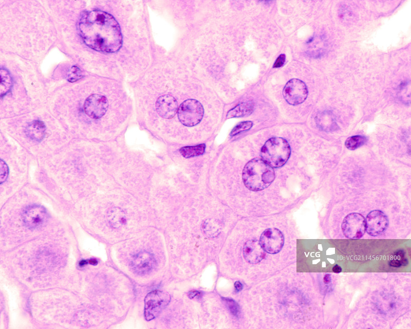 多倍体肝细胞显微照片图片素材