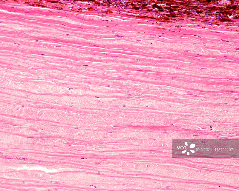 巩膜光学显微照片图片素材