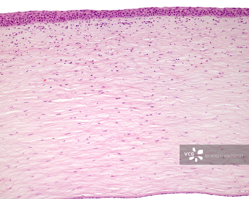 角膜层光学显微照片图片素材