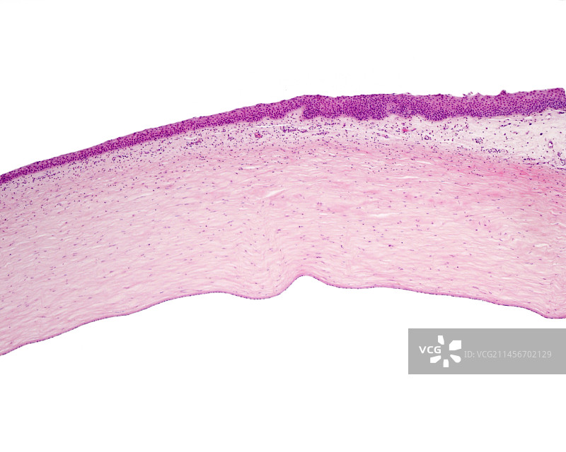 角膜与结膜的光学显微照片图片素材