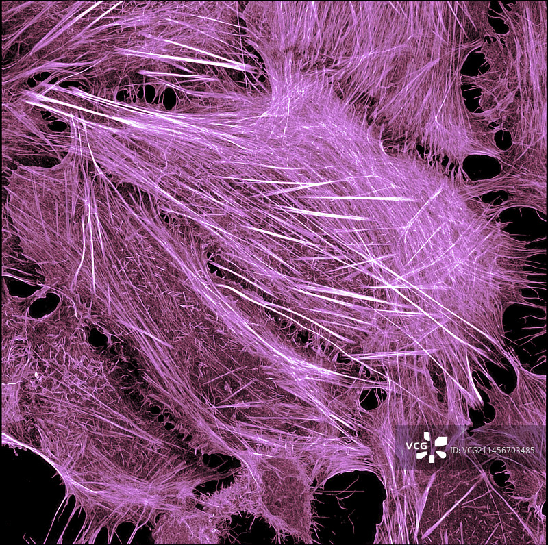 显示肌动蛋白细胞骨架的癌细胞图片素材