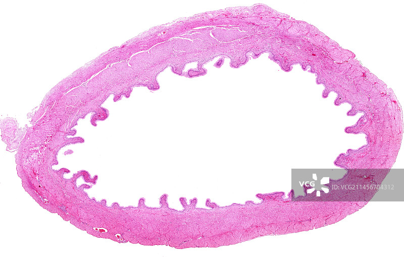 膀胱显微照片图片素材