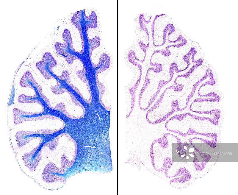 小脑显微照片图片素材