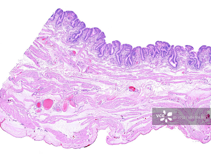 膀胱壁的光学显微照片图片素材
