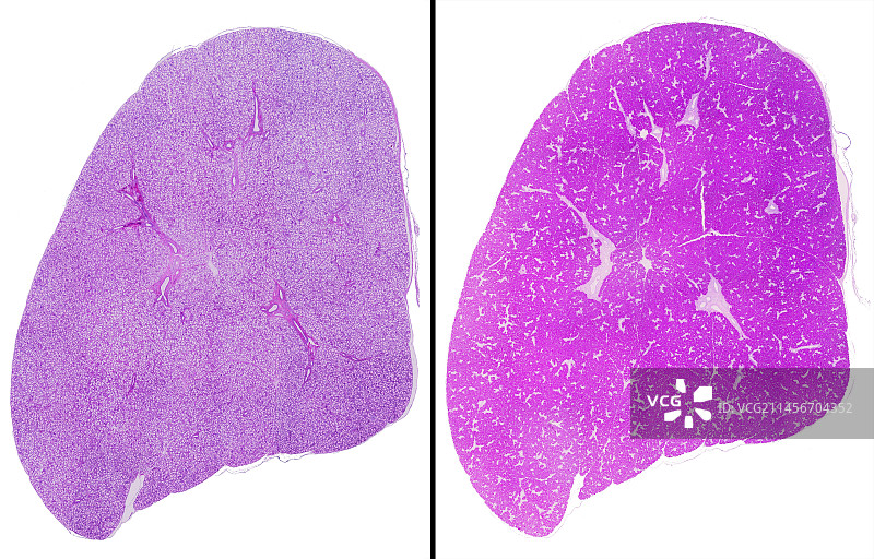 舌下腺光学显微照片图片素材