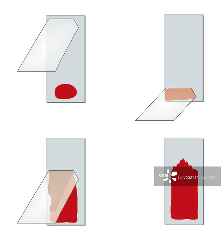 血涂片制备技术示意图片素材