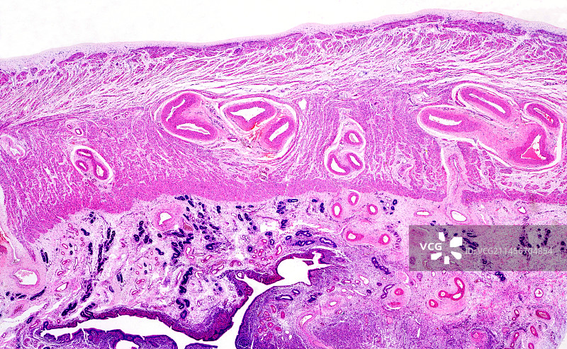 人宫颈显微照片图片素材