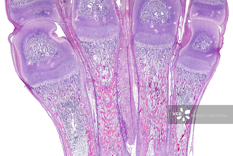 软骨内骨化，光学显微照片图片素材