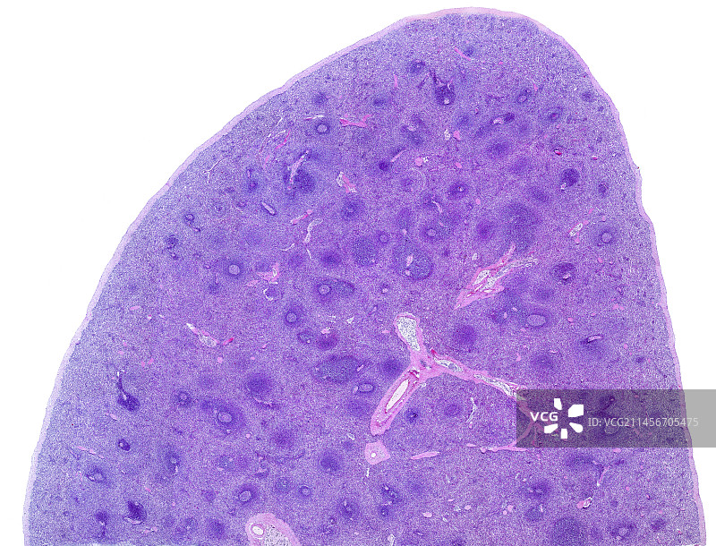 人类脾脏，光学显微照片图片素材