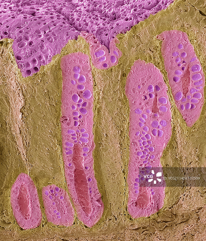 子宫内膜扫描电镜图图片素材