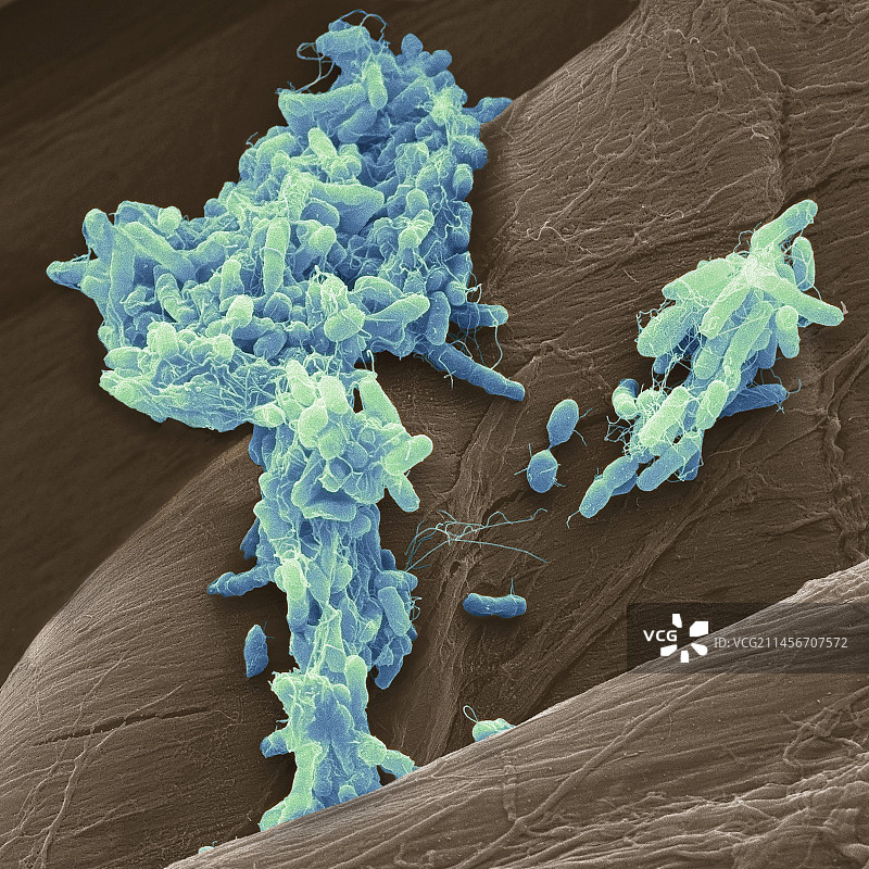 沙门氏菌，扫描电镜图片素材