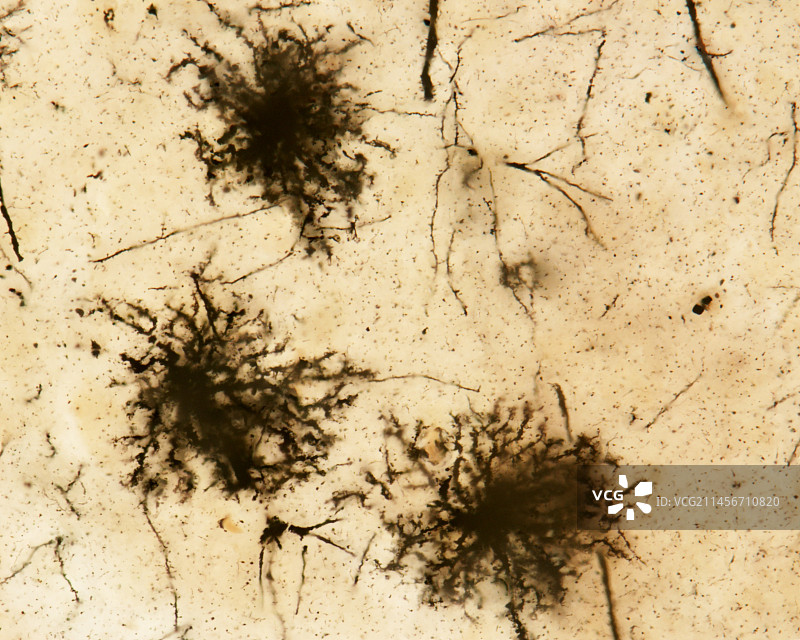 原生质星形胶质细胞显微照片图片素材