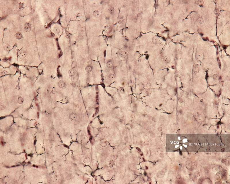 小胶质细胞显微照片图片素材