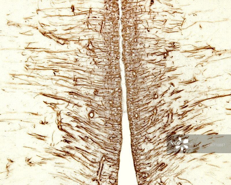 室管膜细胞，光学显微照片图片素材