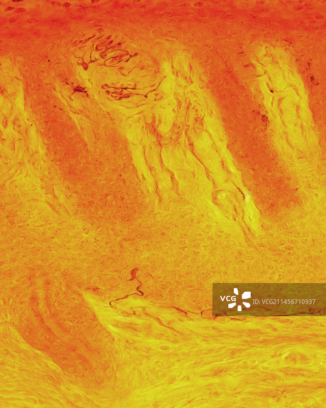 梅克尔神经末梢显微照片图片素材
