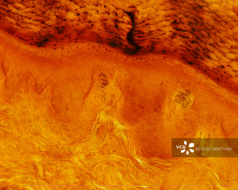 迈斯纳小体，光学显微照片图片素材