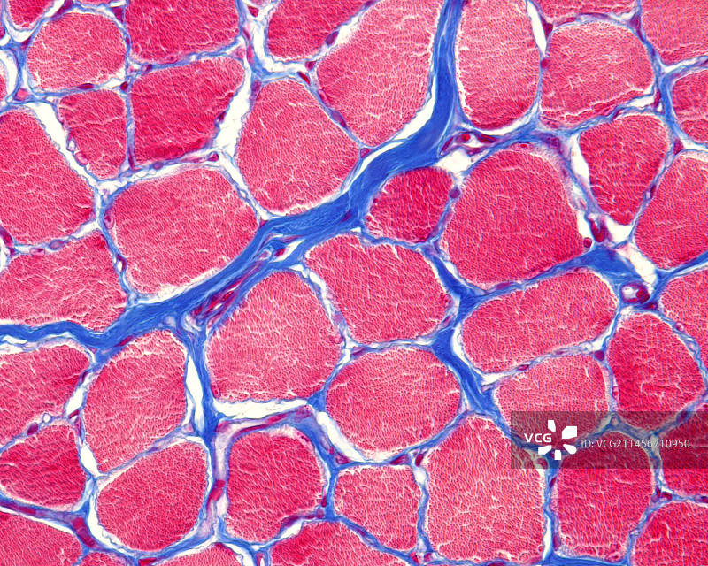 骨骼肌横纹，光学显微照片图片素材