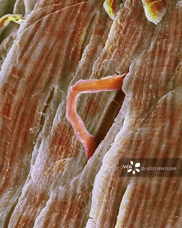 心肌细胞发育扫描电镜图图片素材