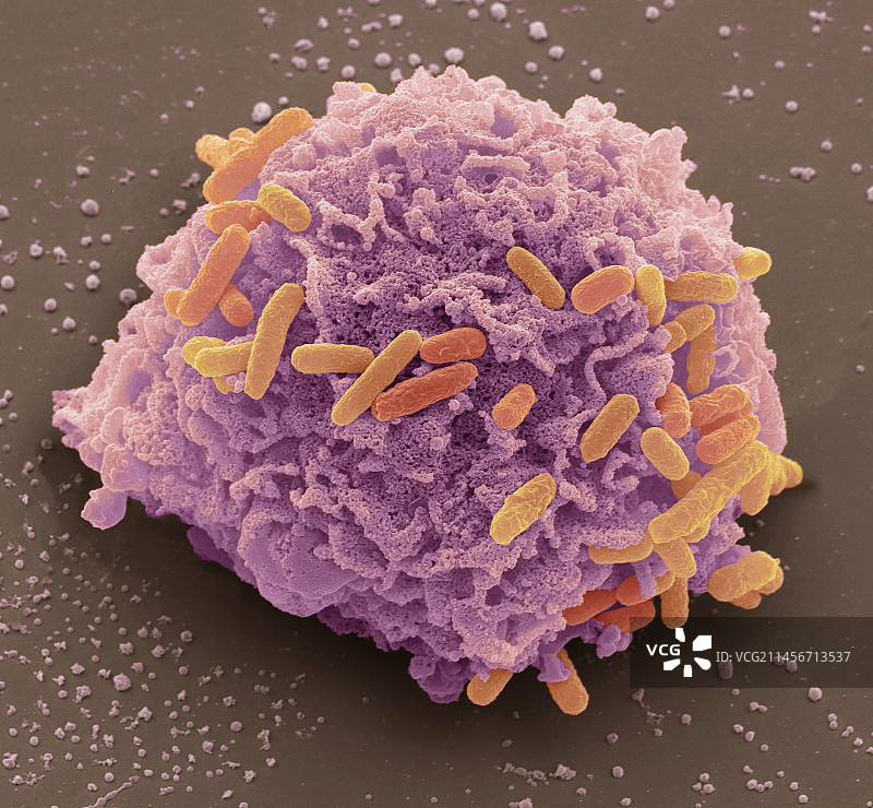 细菌细胞感染，扫描电镜图片素材