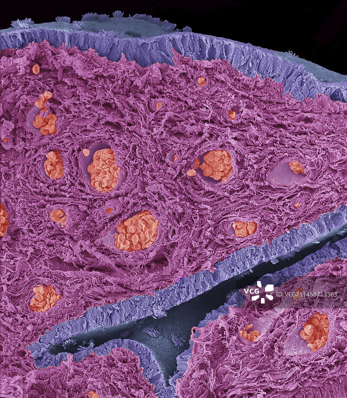 输卵管伞，扫描电镜图片素材