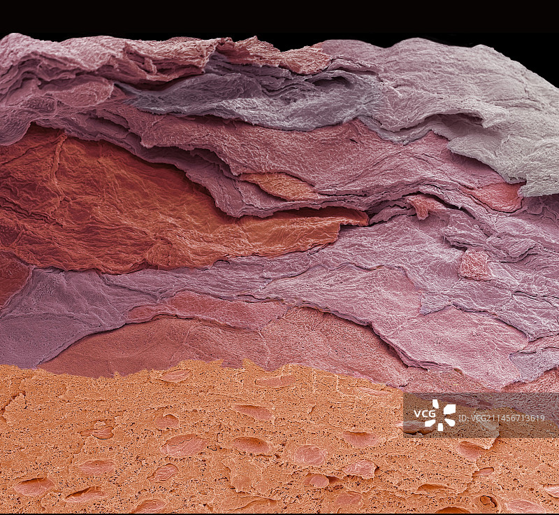 人的指尖皮肤扫描电镜图图片素材