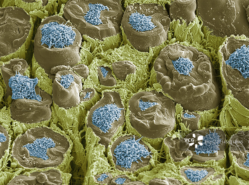 有髓神经，扫描电镜图片素材