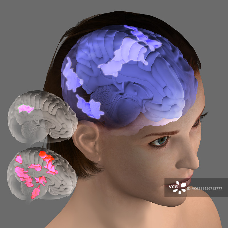 冥想控制疼痛插画图片素材