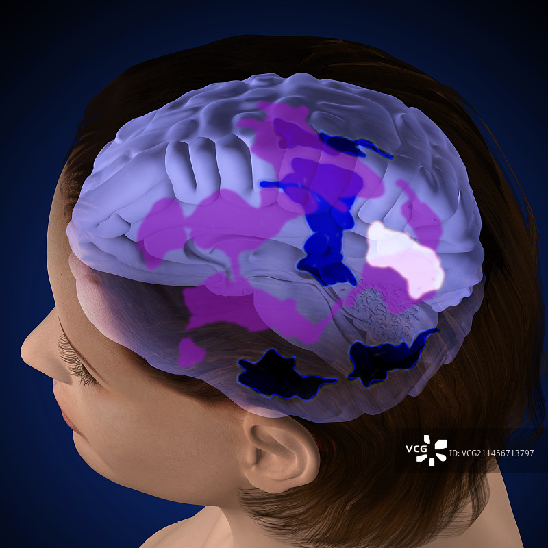 冥想控制疼痛插画图片素材