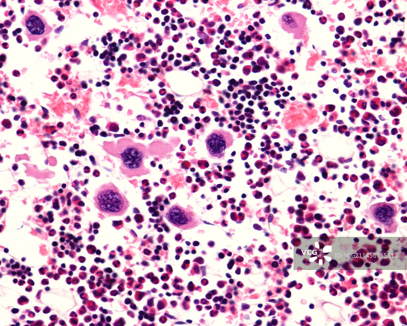 骨髓中的巨核细胞图片素材