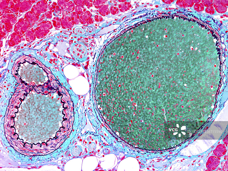 血管显微照片图片素材