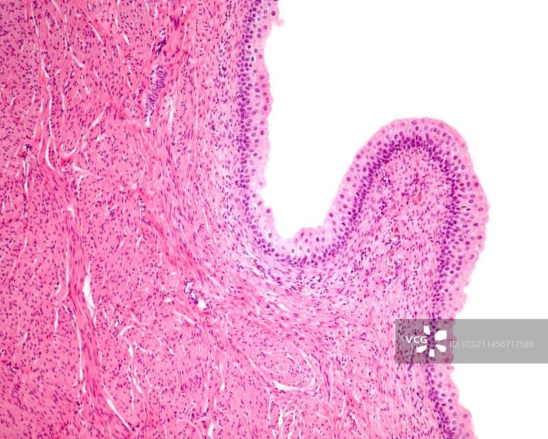 膀胱黏膜显微照片图片素材