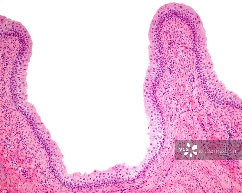 膀胱黏膜显微照片图片素材