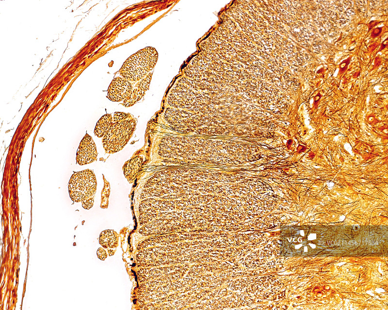 脊髓腹根显微照片图片素材